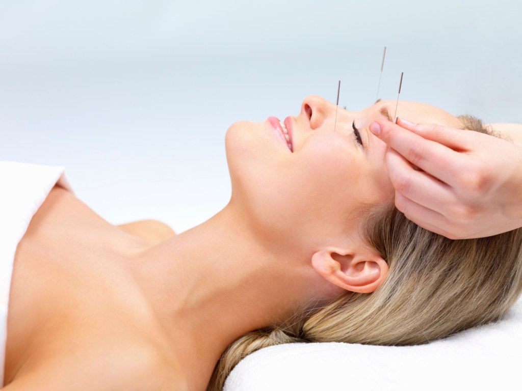 The Everyman Guide to&nbsp;Acupuncture